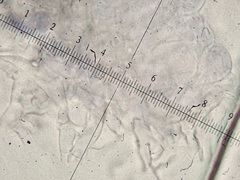 Lepiota parvannulata