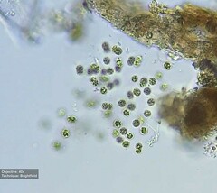 Microcystis