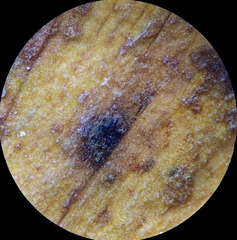 Bartheletia paradoxa