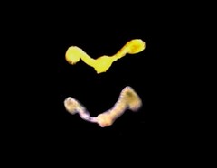 Pseudocrossidium hornschuchianum