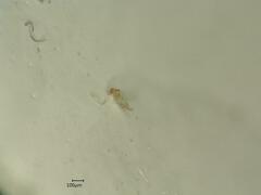 Edwardsiana frustrator