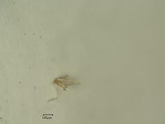 Edwardsiana frustrator