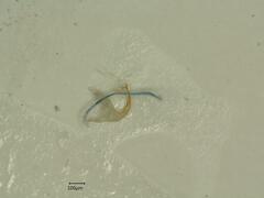 Edwardsiana ulmiphagus