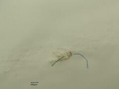 Edwardsiana ulmiphagus