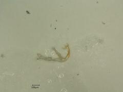 Edwardsiana ulmiphagus