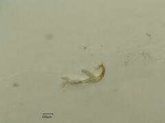 Edwardsiana ulmiphagus