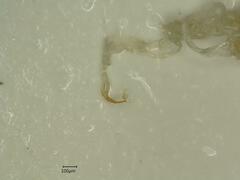 Edwardsiana ulmiphagus