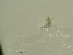 Edwardsiana ulmiphagus