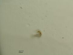 Edwardsiana ulmiphagus