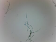 Trichia crateriformis