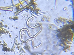 Nematoda