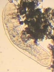 Protozoa