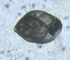 Globobulimina auriculata