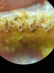 Microtus pennsylvanicus