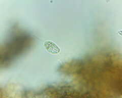 Euglenozoa