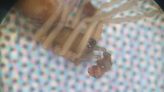 Agyneta simplicitarsis