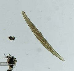 Spirostomum