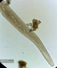 Spirostomum