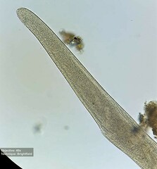 Spirostomum