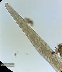 Spirostomum