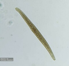 Spirostomum