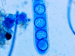 Lamprospora