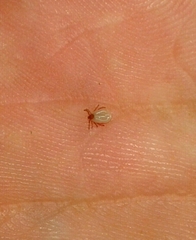 Ixodidae