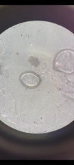 Tyrophagus putrescentiae