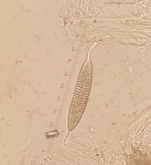 Ocellularia jacinda-arderniae