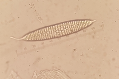 Ocellularia jacinda-arderniae