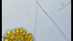 Bacteria