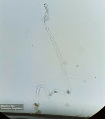 Vorticellidae