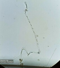 Vorticellidae