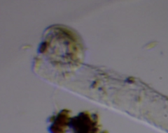 Aspidisca turrita