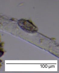 Aspidisca turrita