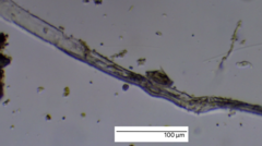 Aspidisca turrita