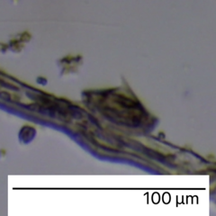 Aspidisca turrita
