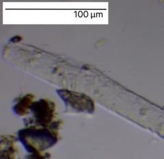 Aspidisca turrita