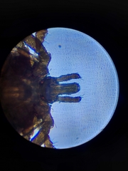 Amblyomma