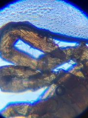 Amblyomma