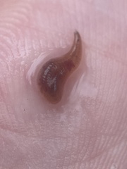 Helobdella
