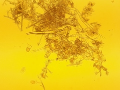 Pseudoperonospora urticae