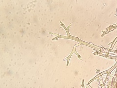 Pseudoperonospora urticae