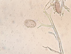Pseudoperonospora urticae