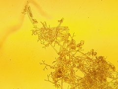 Pseudoperonospora urticae