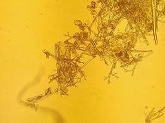 Pseudoperonospora urticae