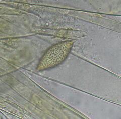 Phaeopezia apiculata