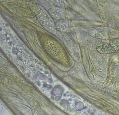 Phaeopezia apiculata