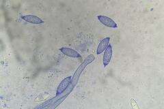 Phaeopezia apiculata