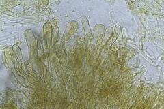 Phaeopezia apiculata